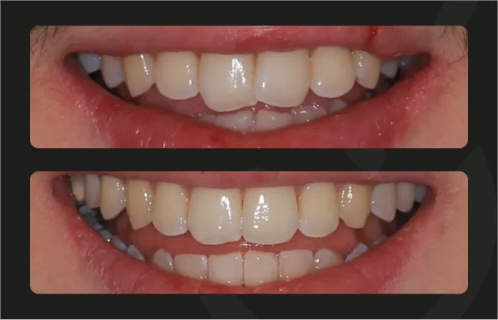 Francisco - Alinhamentos invisíveis